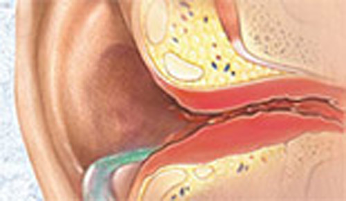 Eartab-Sri Sai Hospital