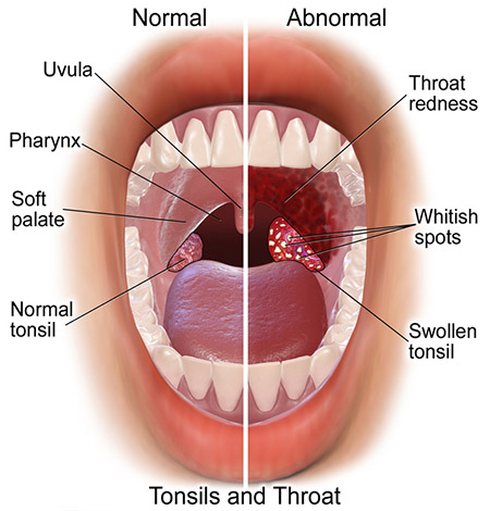 throat-Sri Sai Hospital